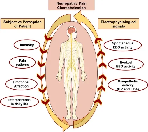 Neuropathic Pain Infographic