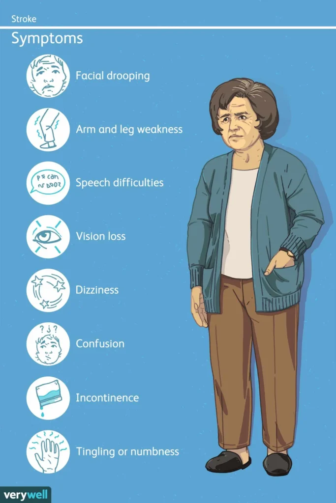 Symptoms of Post-Stroke Pain Infographic