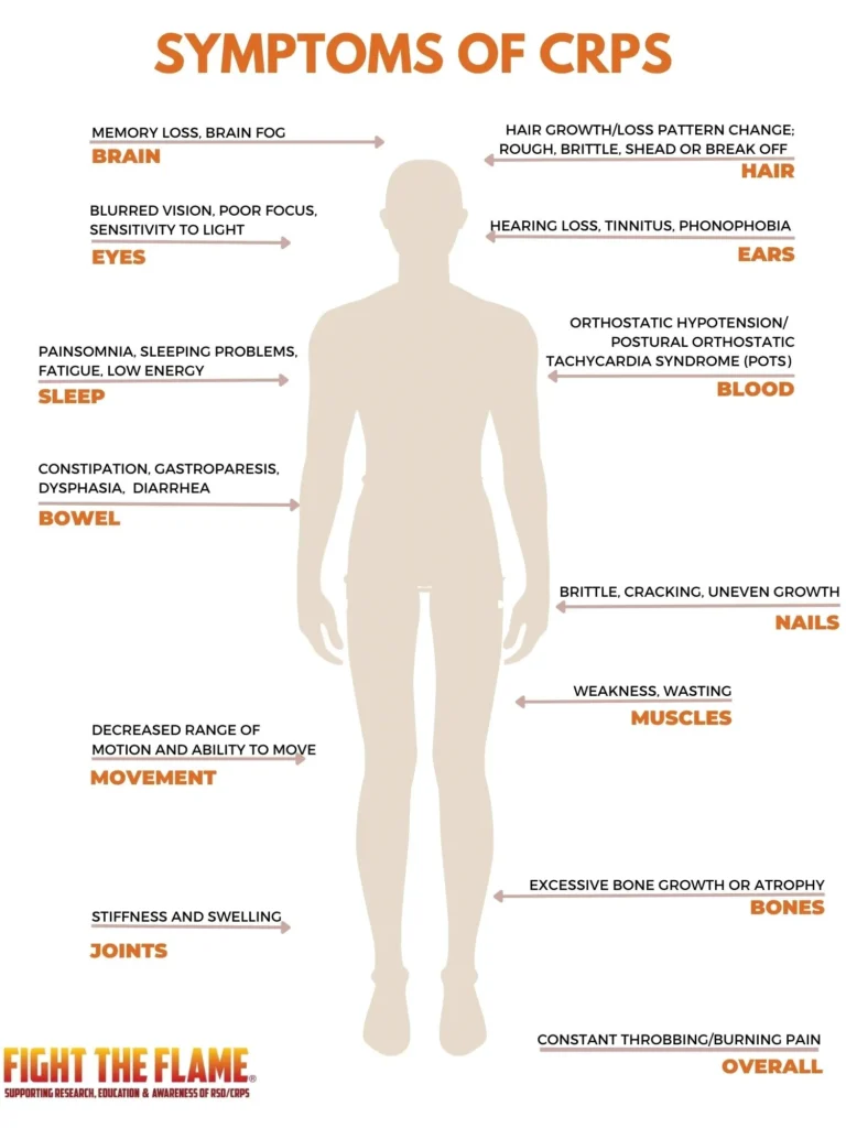 crps Infographic